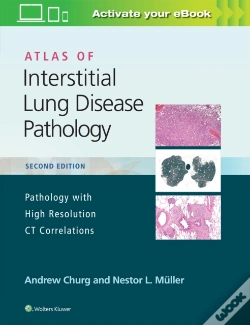 Capa do artigo Atlas Of Interstitial Lung Disease Pathology