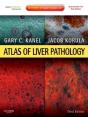 Atlas Of Liver Pathology E-Book - Preview