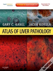 Capa do artigo Atlas Of Liver Pathology E-Book