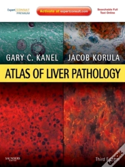 Capa do artigo Atlas Of Liver Pathology E-Book