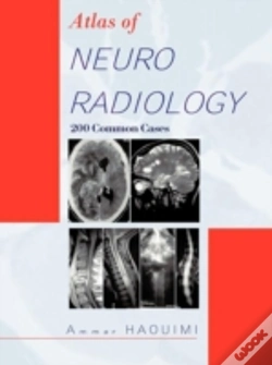 Capa do artigo Atlas Of Neuroradiology