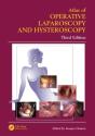 Atlas Of Operative Laparoscopy And Hysteroscopy - Preview