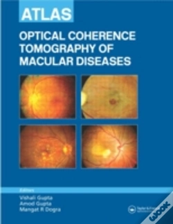 Capa do artigo Atlas Of Optical Coherence Tomography Of Macular Diseases