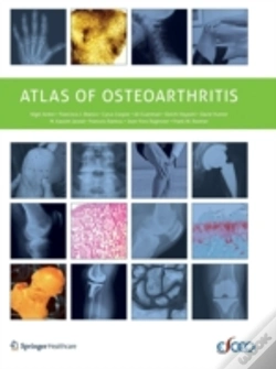 Capa do artigo Atlas Of Osteoarthritis