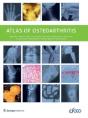 Atlas Of Osteoarthritis - Preview
