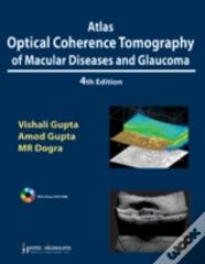 Atlas Optical Coherence Tomography Of Macular Diseases And Glaucoma