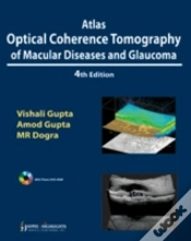 Capa do artigo Atlas Optical Coherence Tomography Of Macular Diseases And Glaucoma