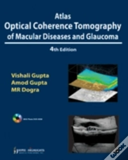 Capa do artigo Atlas Optical Coherence Tomography Of Macular Diseases And Glaucoma
