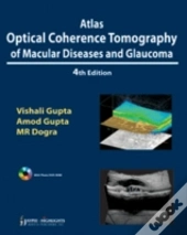 Atlas Optical Coherence Tomography Of Macular Diseases And Glaucoma
