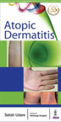 Atopic Dermatitis - Preview