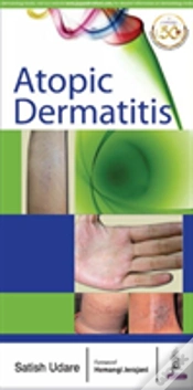 Capa do artigo Atopic Dermatitis