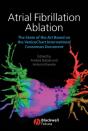 Atrial Fibrillation Ablation - Preview