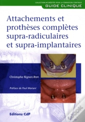 Attachement Et Prothese Complete Supraradiculaire Et Supra Implantaire