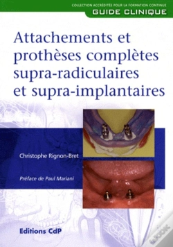 Capa do artigo Attachement Et Prothese Complete Supraradiculaire Et Supra Implantaire