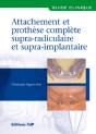 Attachements Et Prothèse Complète Supra-Radiculaire Et Supra-Implantaire - Preview