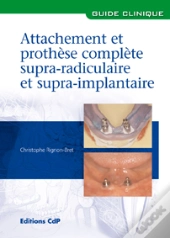 Attachements Et Prothèse Complète Supra-Radiculaire Et Supra-Implantaire