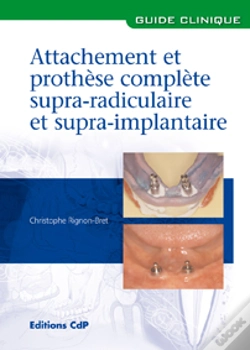 Capa do artigo Attachements Et Prothèse Complète Supra-Radiculaire Et Supra-Implantaire