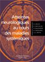 Atteintes Neurologiques Au Cours Des Maladies Systémiques - Preview