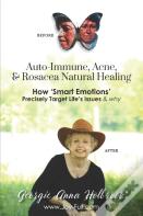 Auto-Immune, Acne, & Rosacea Natural Healing - How 'Smart Emotions' Precisely Target Life'S Issues & Why