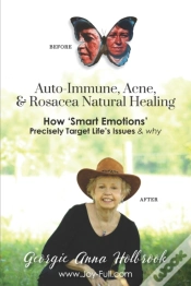Capa do artigo Auto-Immune, Acne, & Rosacea Natural Healing - How 