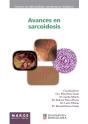 Avances En Sarcoidosis - Preview