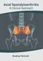 Axial Spondyloarthritis: A Clinical Appr - Preview