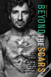 Beyond The Scars