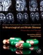 Bioactive Nutraceuticals And Dietary Supplements In Neurological And Brain Disease - Preview