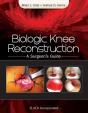 Biologic Knee Reconstruction - Preview