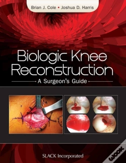 Capa do artigo Biologic Knee Reconstruction