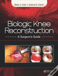 Capa do artigo Biologic Knee Reconstruction