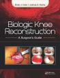 Biologic Knee Reconstruction - Preview