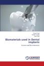 Biomaterials Used In Dental Implants - Preview
