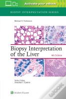 Biopsy Interpretation Of The Liver