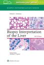 Biopsy Interpretation Of The Liver - Preview