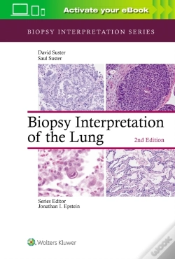Capa do artigo Biopsy Interpretation Of The Lung