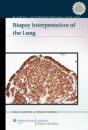 Biopsy Interpretation Of The Lung - Preview