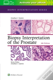 Biopsy Interpretation Of The Prostate