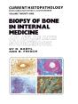 Biopsy Of Bone In Internal Medicine: An Atlas And Sourcebook - Preview