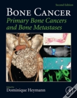 Capa do artigo Bone Cancer