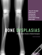 Capa do artigo Bone Dysplasias
