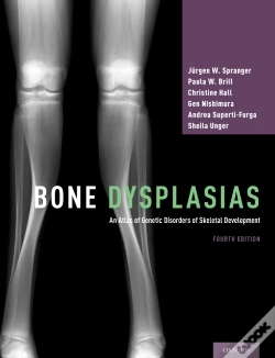 Capa do artigo Bone Dysplasias