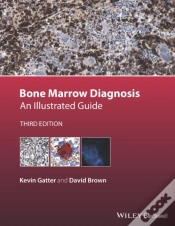 Capa do artigo Bone Marrow Diagnosis