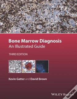 Capa do artigo Bone Marrow Diagnosis