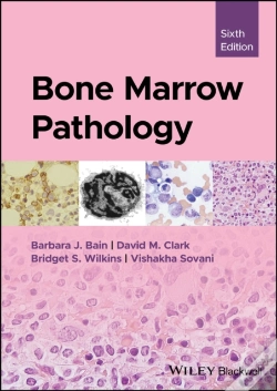 Capa do artigo Bone Marrow Pathology