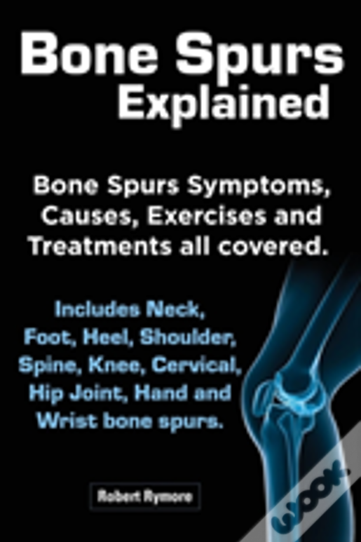 Bone Spurs Explained. Bone Spurs Symptoms, Causes, Exercises And Treatments All Covered. Includes Neck, Foot, Heel, Shoulder, Spine, Knee, Cervical, H