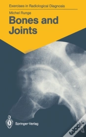 Capa do artigo Bones And Joints