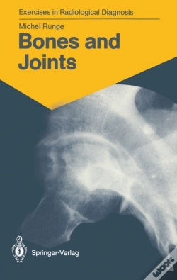 Capa do artigo Bones And Joints