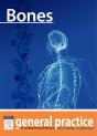 Bones - Preview