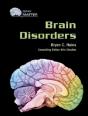 Brain Disorders - Preview